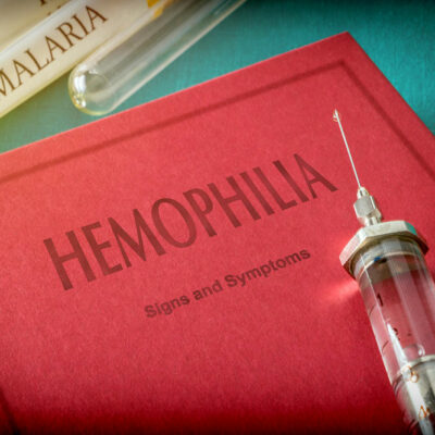 3 Popular Treatment Options for Hemophilia