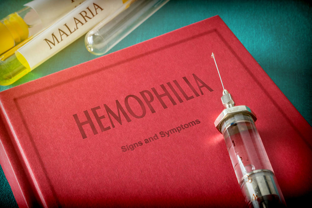 3 Popular Treatment Options for Hemophilia