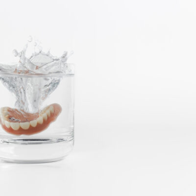 5 Things to Consider Before Getting Dentures